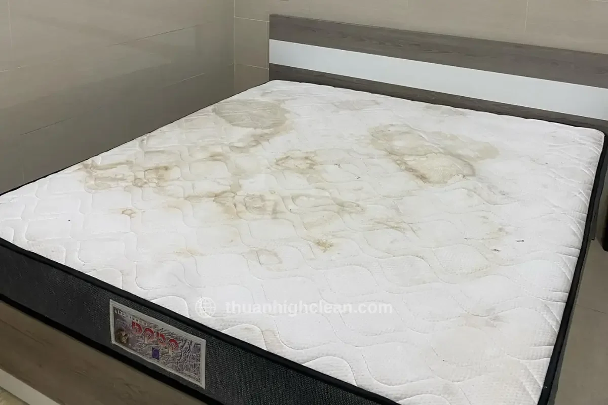 Trước Vệ Sinh